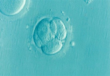 Alabama Yüksek Mahkemesi: Embriyo çocuk kabul edilmeli