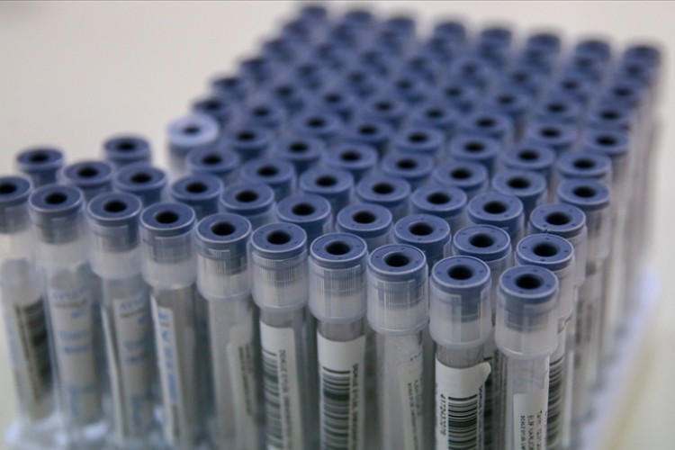 Bazı alanlarda PCR testi zorunluluğu kaldırıldı