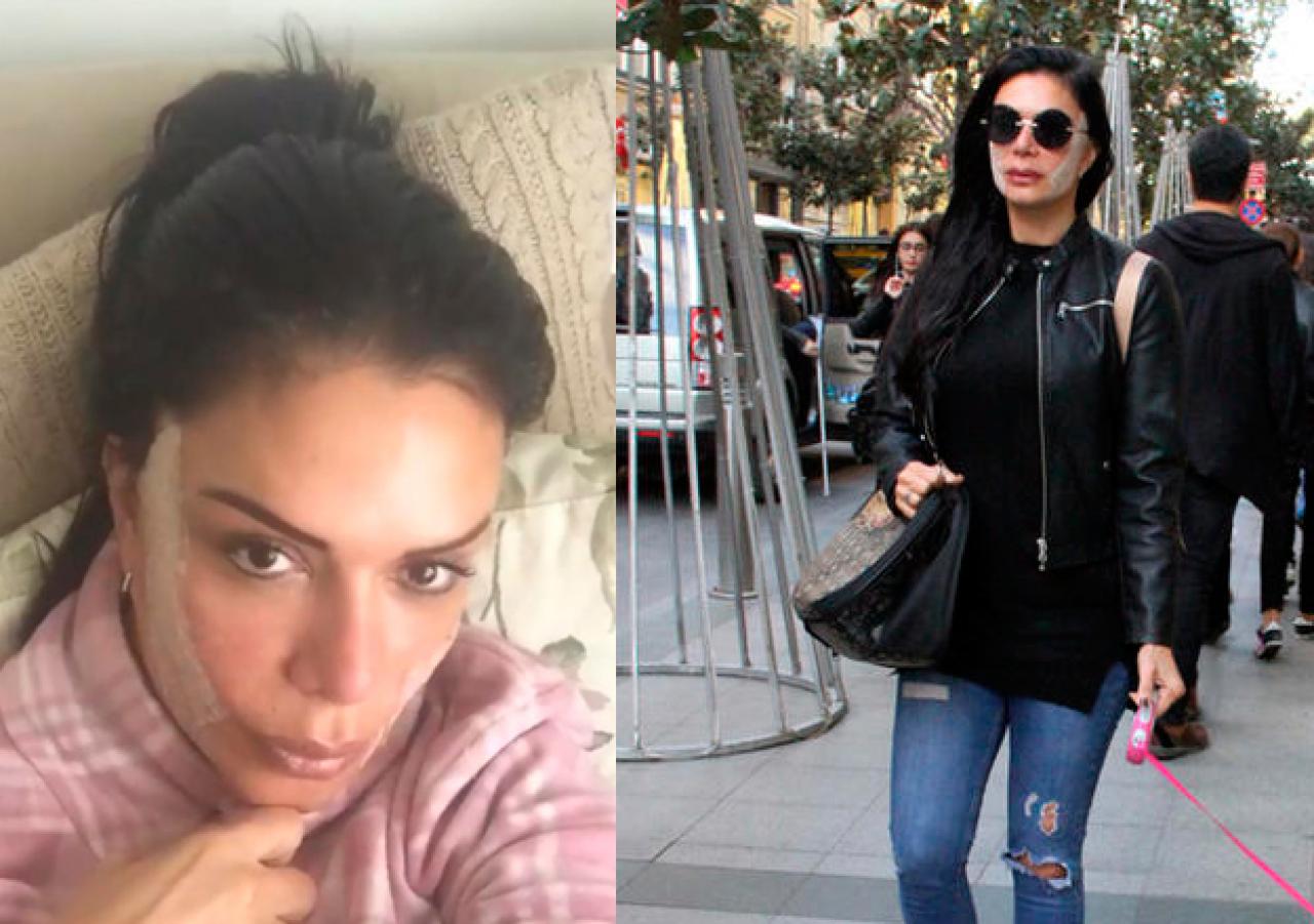 Sevda Demirel Kim Kardashian'a benzemek için ant içti!