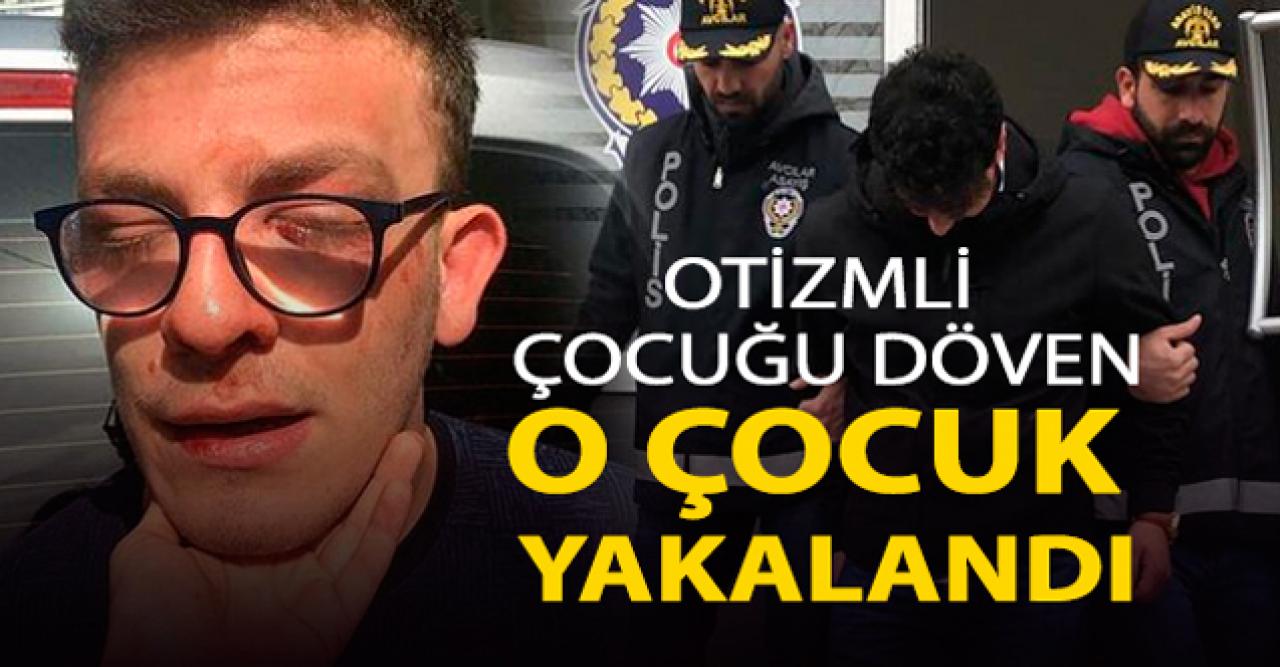 Otizmli çocuk Taha Alper Behrem'i döven o çocuk yakalandı!