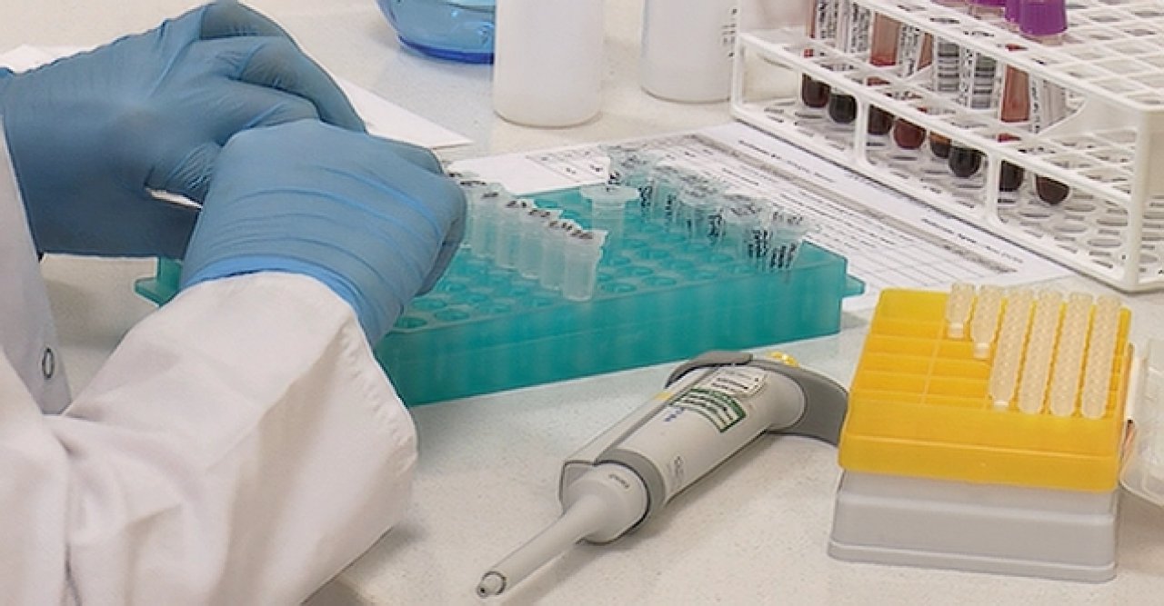 Düğün sezonu öncesi 'SMA taraması' uyarısı