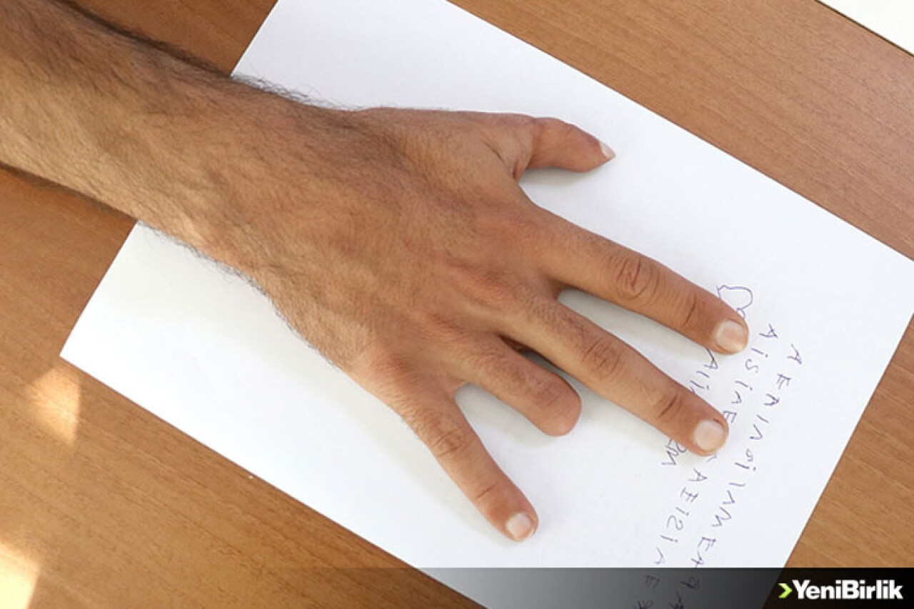 Konya'da yapılan 'parmak nakli' literatüre girdi