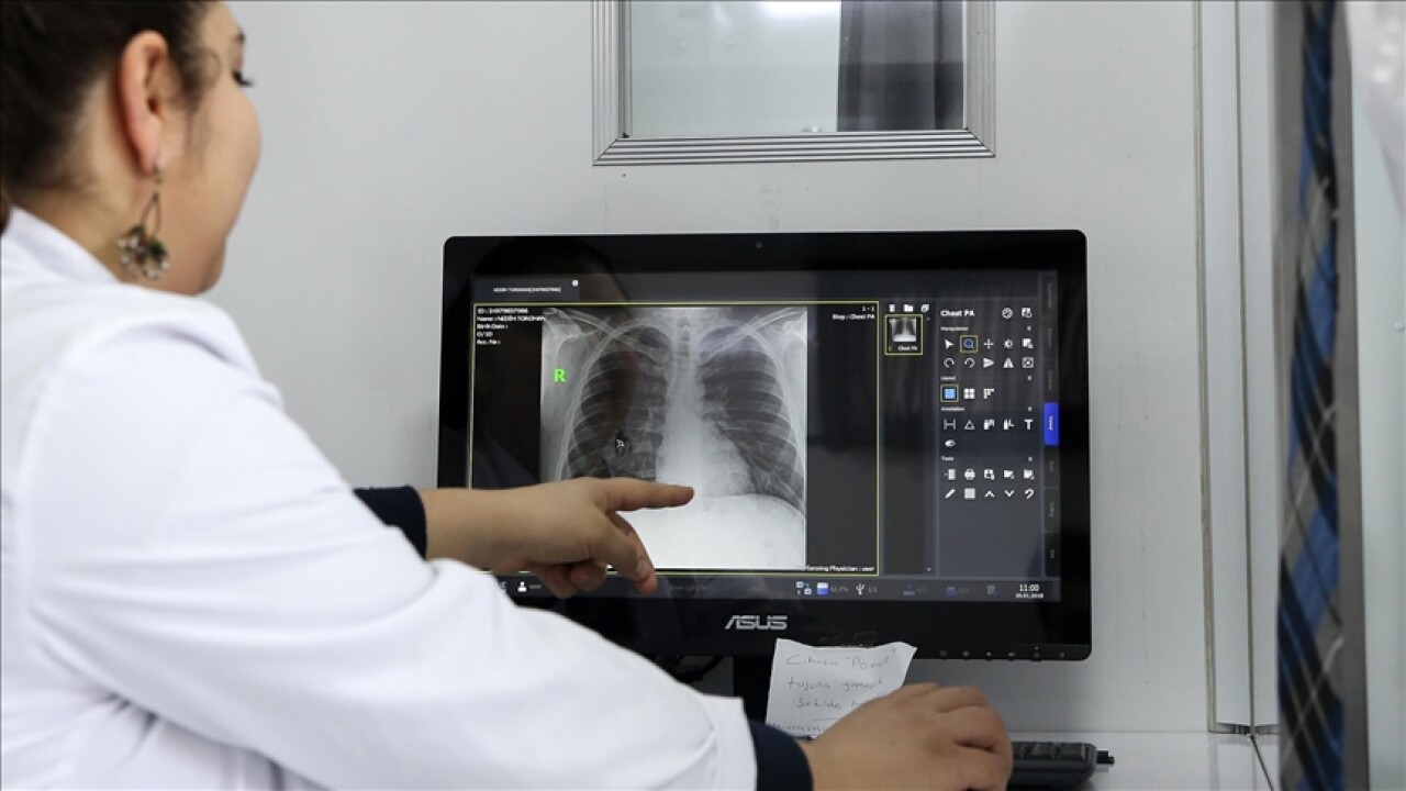 DSÖ'den tüberküloz uyarısı: 1995'ten bu yana en yüksek oran