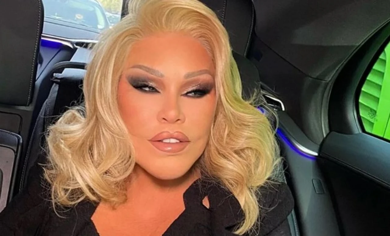 Jocelyn Wildenstein Kimdir, Neden Öldü, Hastalığı Neydi? “Kedi Kadın” Hayatı ve Biyografisi
