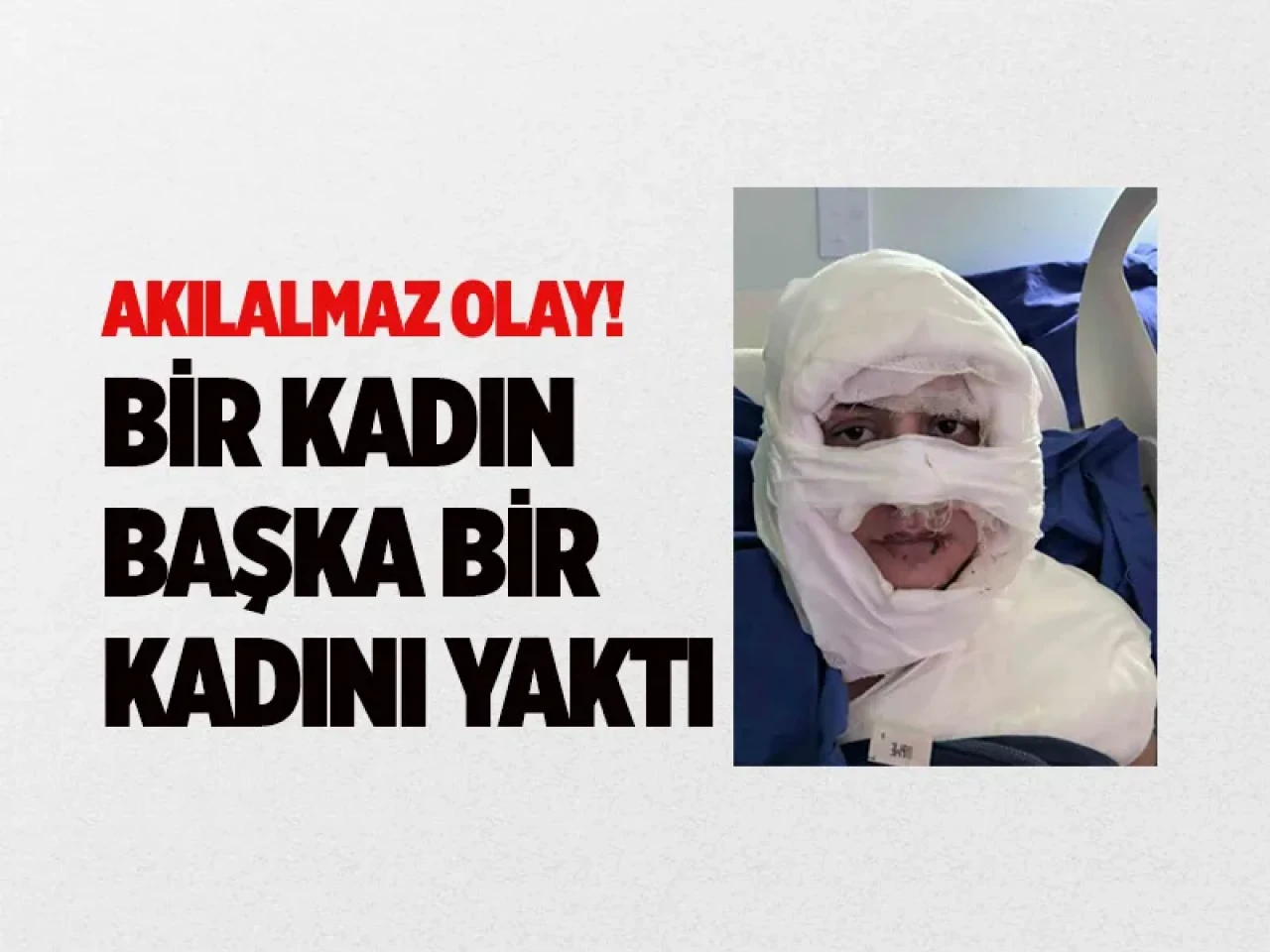 Kadıköy’de akıl almaz olay: Genç kadın başka bir kadın tarafından ateşe verildi