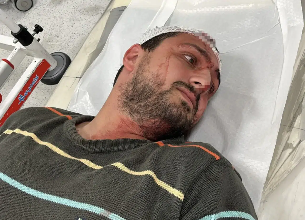 Savunmasızdı... Otizmli gence odunla dehşet!