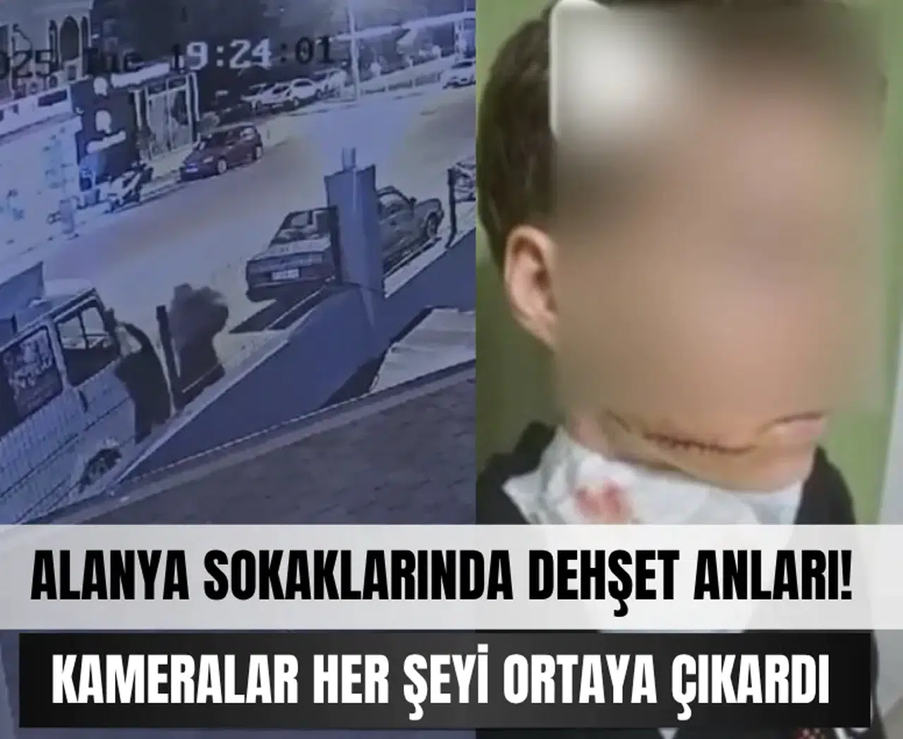 Alanya’da şok saldırı! Kameralar her şeyi ortaya çıkardı