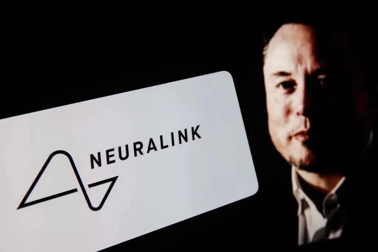 İnsan zihni artık makineyi yönlendiriyor: Neuralink’ten dönüm noktası!
