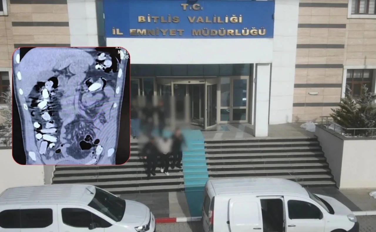 Uyuşturucu kuryelerinin akıl almaz yöntemi: Midesinden 96 paket çıktı!