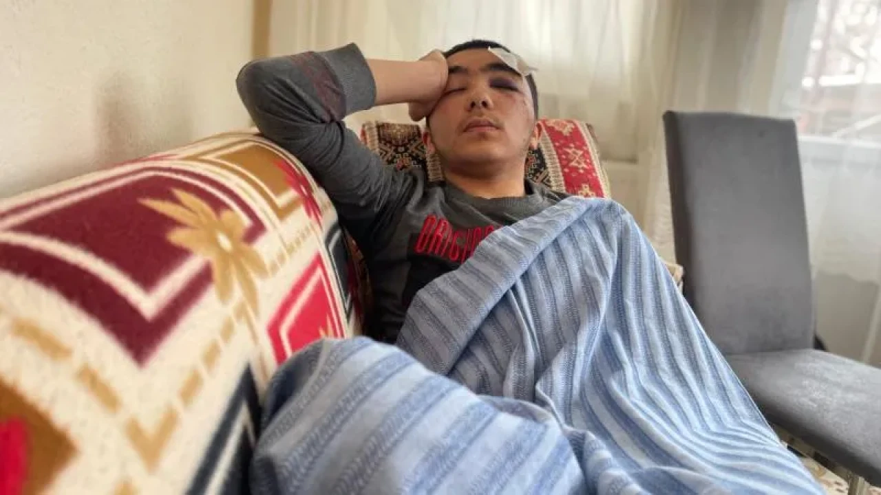 Sahipsiz köpeklerin saldırısına uğrayan genç, kafa travması geçirdi