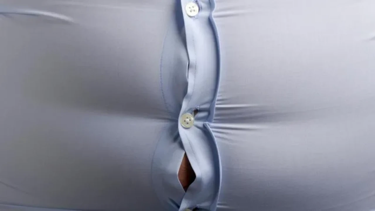 Korkutan Rapor: 2050’de 3,8 Milyar Yetışkin Obez Olacak!