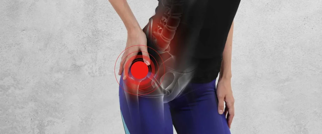 Kalça Ağrınız Geçmiyorsa Dikkat! Bu Hastalıkların Belirtisi Olabilir