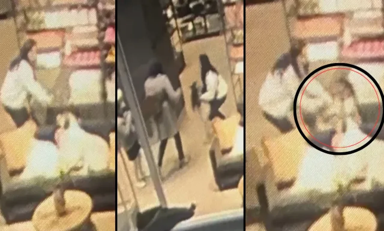 AVM’de Dehşet! Küçük Kız Sevdiği Köpek Tarafından Yüzünden Isırıldı!