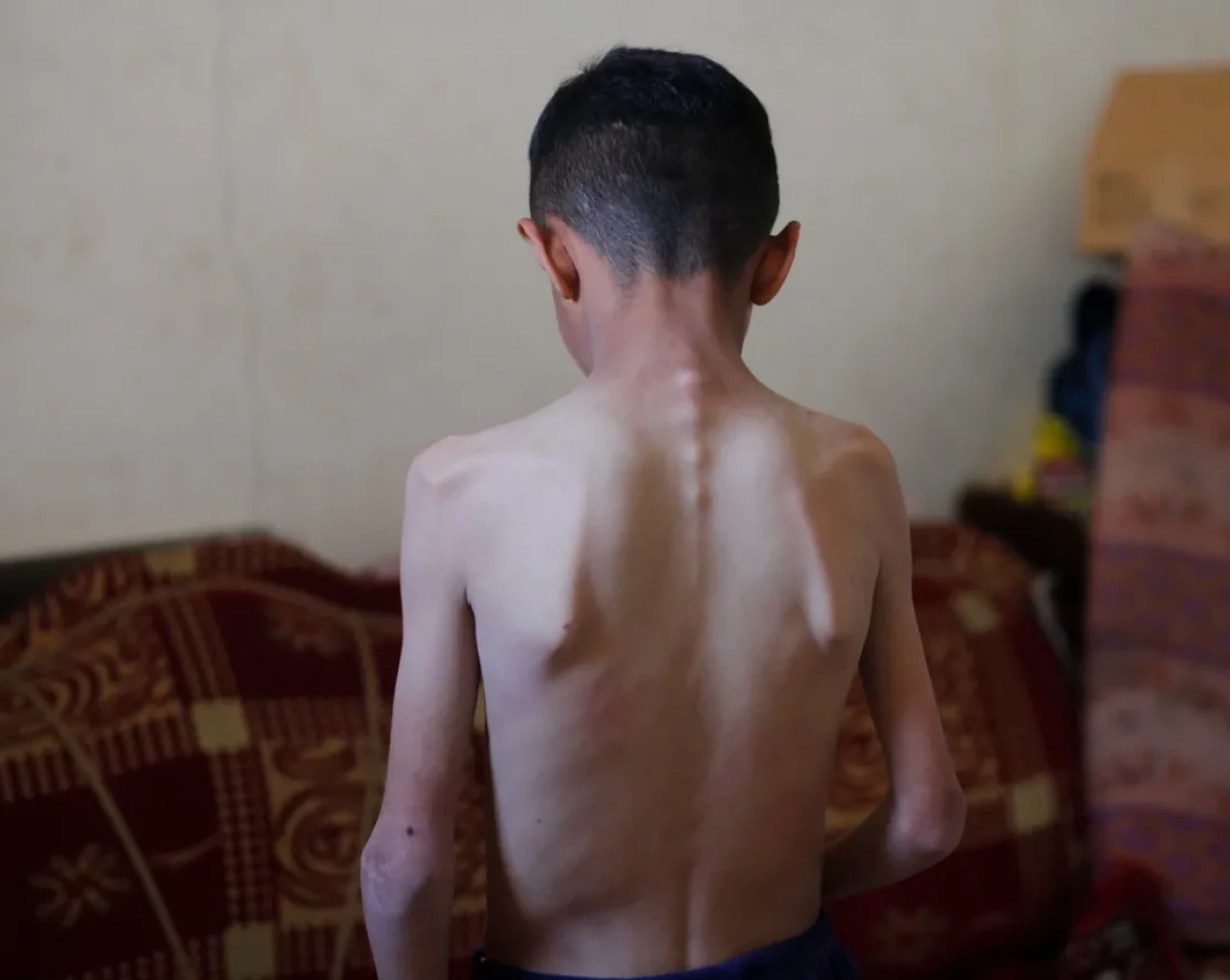 İsrail’in Ablukası Gazze’de İnsani Krizi Derinleştiriyor: Çocuklar Hayatta Kalma Mücadelesi Veriyor