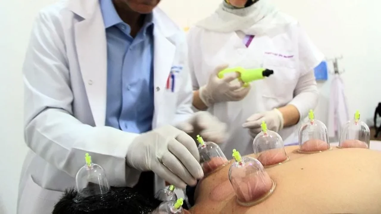 Hacamat Nedir, Faydaları Nelerdir, 2025'te Hangi Günler Yapılır, Noktaları Nelerdir?