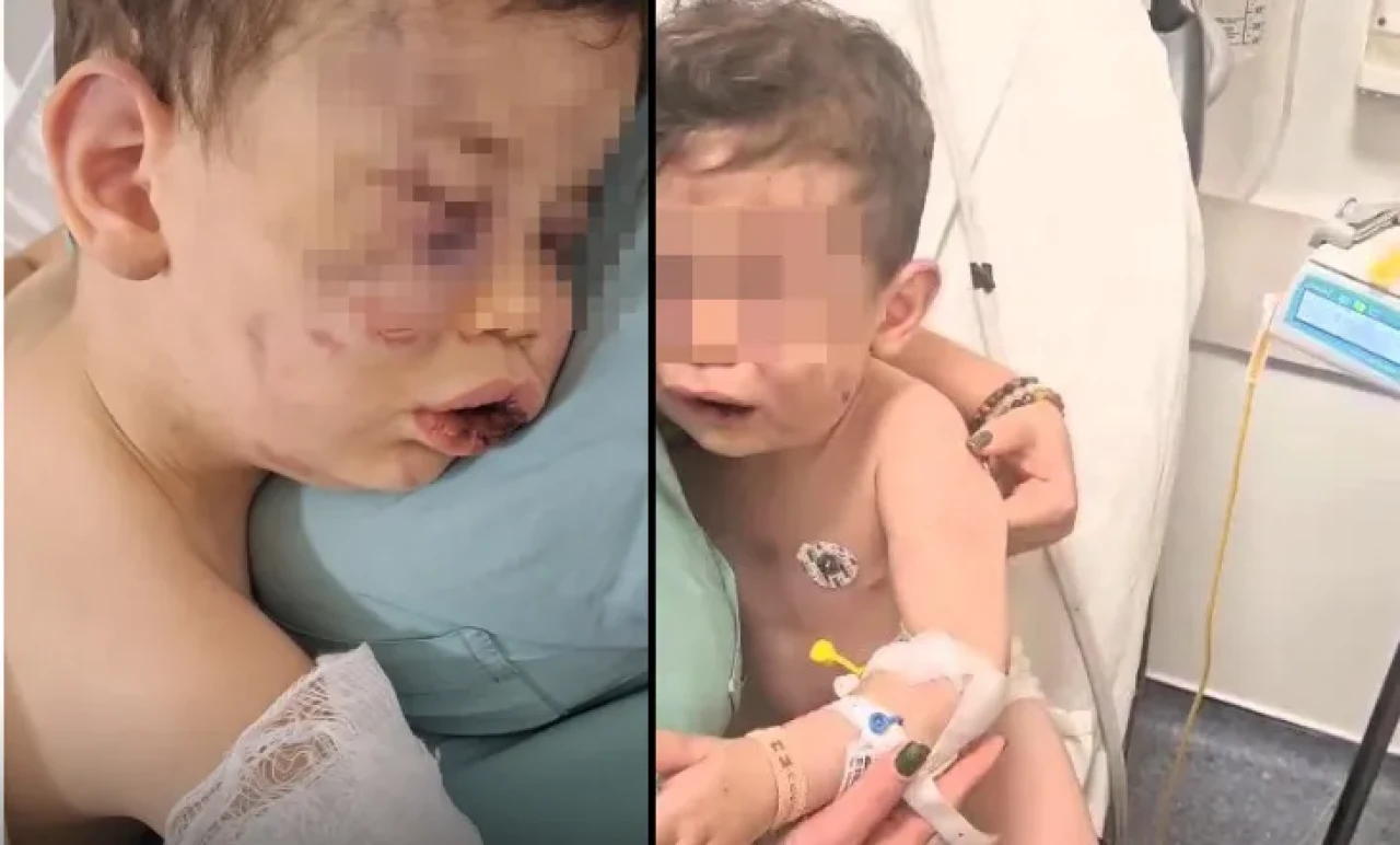 İnsanlık Dışı Şiddet! 2 Yaşındaki Çocuğa Vahşet, Anne Sevgilisini Suçladı