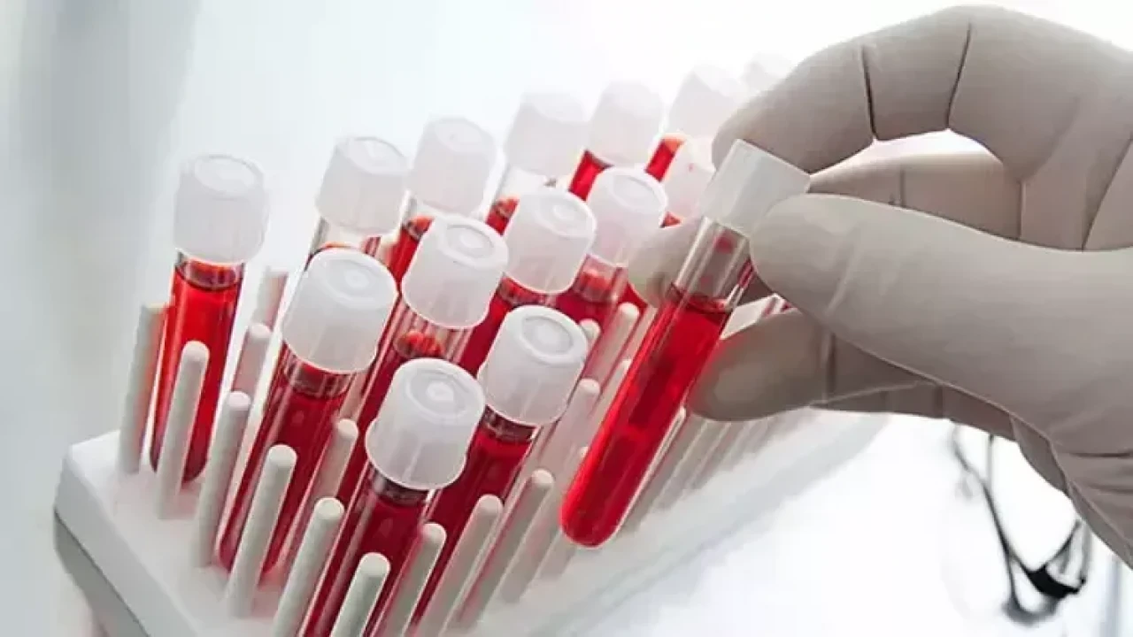 Tıp Tarihine Damga Vurdu: Dünyada Sadece Bir Kişide Bulunan Kan Grubu Keşfedildi!