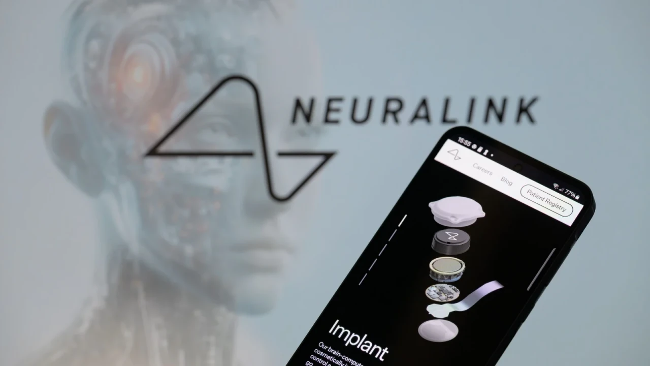 Elon Musk'ın Neuralink beyin implantını kimler kullanıyor? 7 kişide var