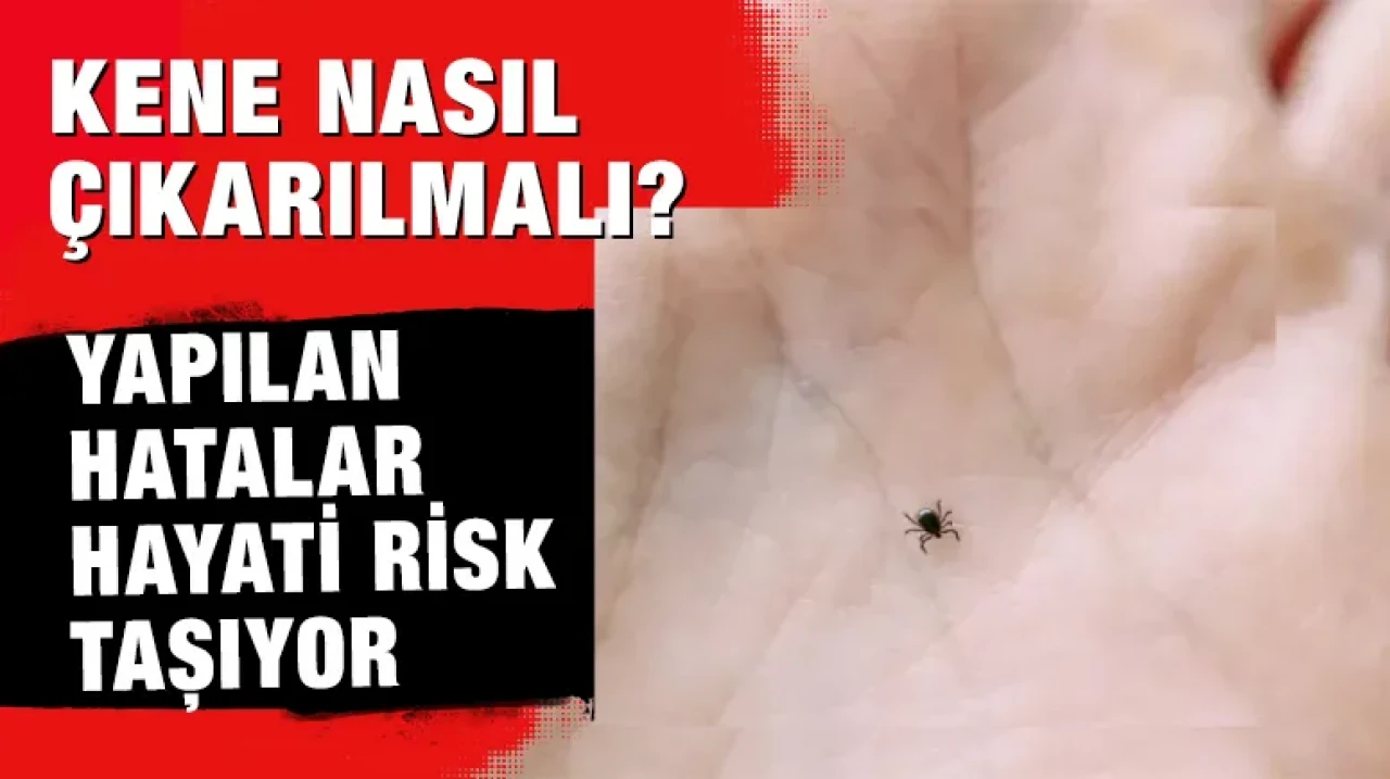 Kene Nasıl Çıkarılmalı? Yapılan Hatalar Hayati Risk Taşıyor