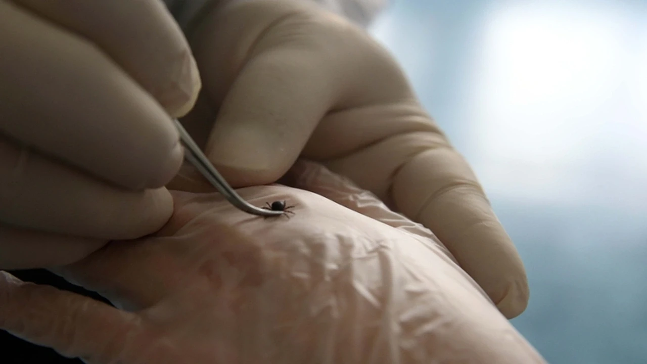 Vücudundaki Keneyi Görünce Hastaneye Koştu Ama... Acı Son!