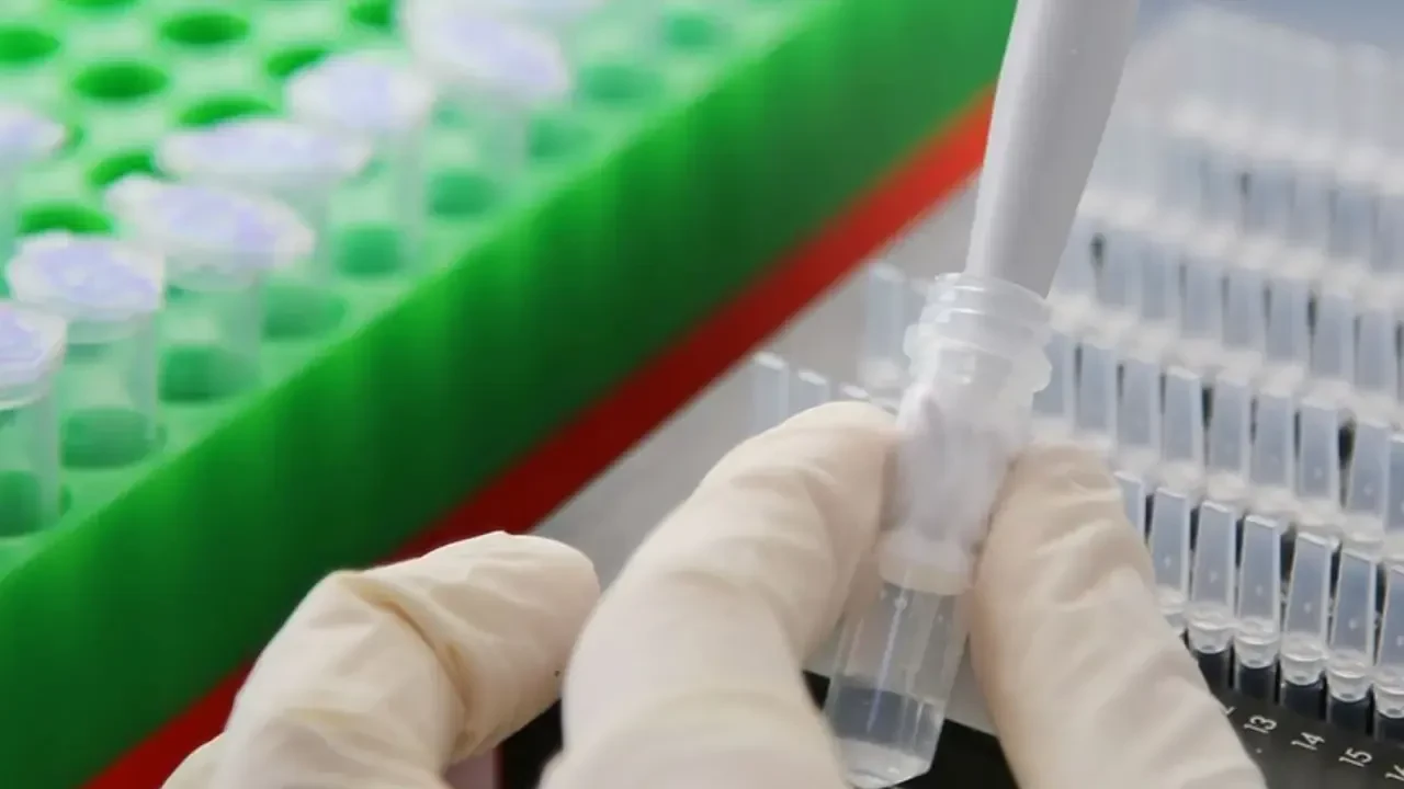 2025 Patoloji Laboratuvar Teknikleri Taban Puanları Açıklandı! En Düşük ve En Yüksek Puanlar Burada