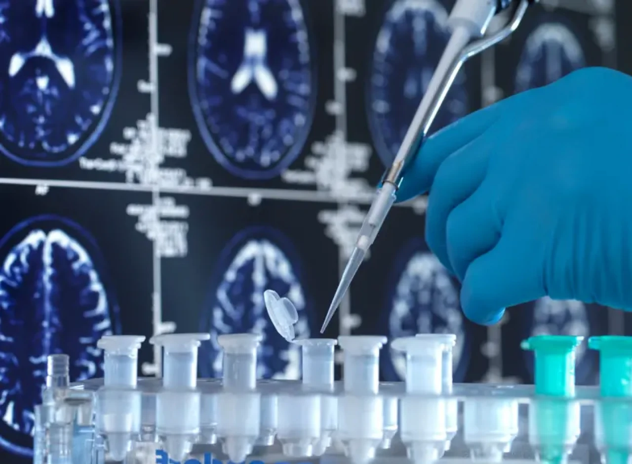 Yeni Araştırma: Aşı ile Alzheimer’a “Dur” Demek Mümkün mü?