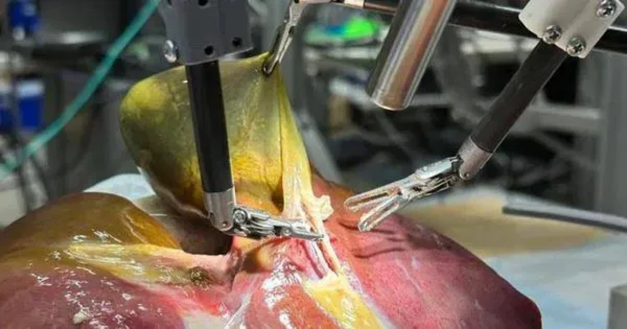 Robotik cerrahide devrim: İlk kez bir ameliyatı tamamen otonom bir robot gerçekleştirdi