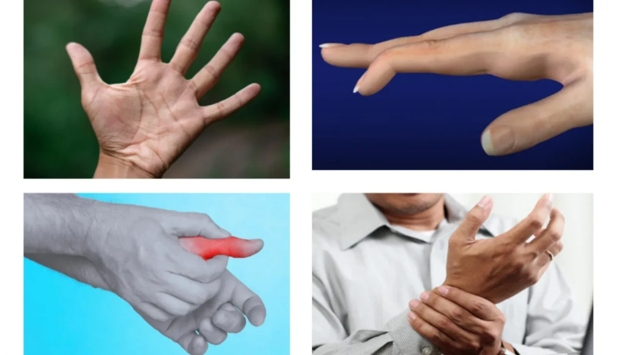 Elleriniz uyuşuyorsa dikkat! Altında yatan neden ciddi olabilir