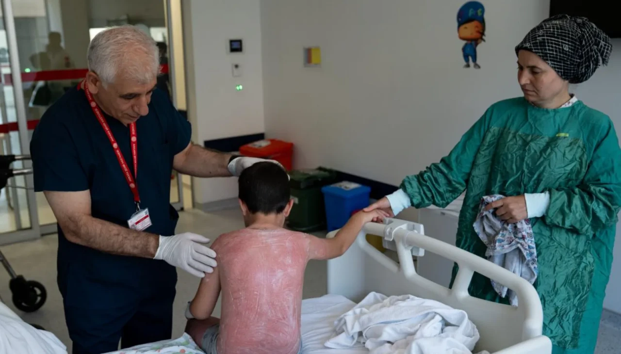 Güneşte 4 saat kalan çocuk ikinci derece yanıkla hastanelik oldu