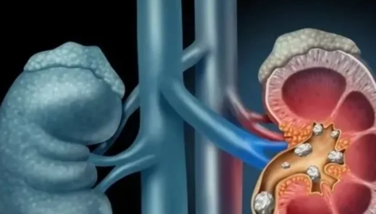 Sessiz tehlike: İdrar yolu enfeksiyonları ve korunma yolları