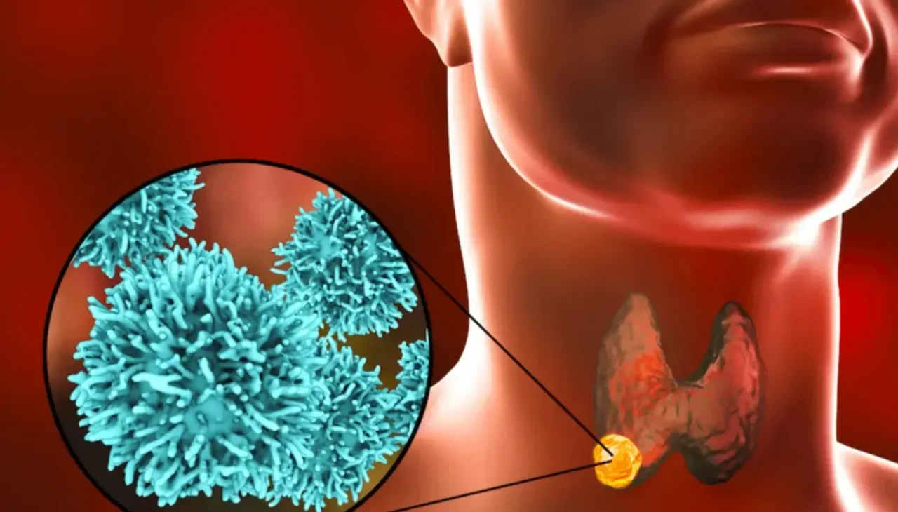 Unutkanlık, depresyon, saç dökülmesi... Belki de tiroidin alarm veriyor!