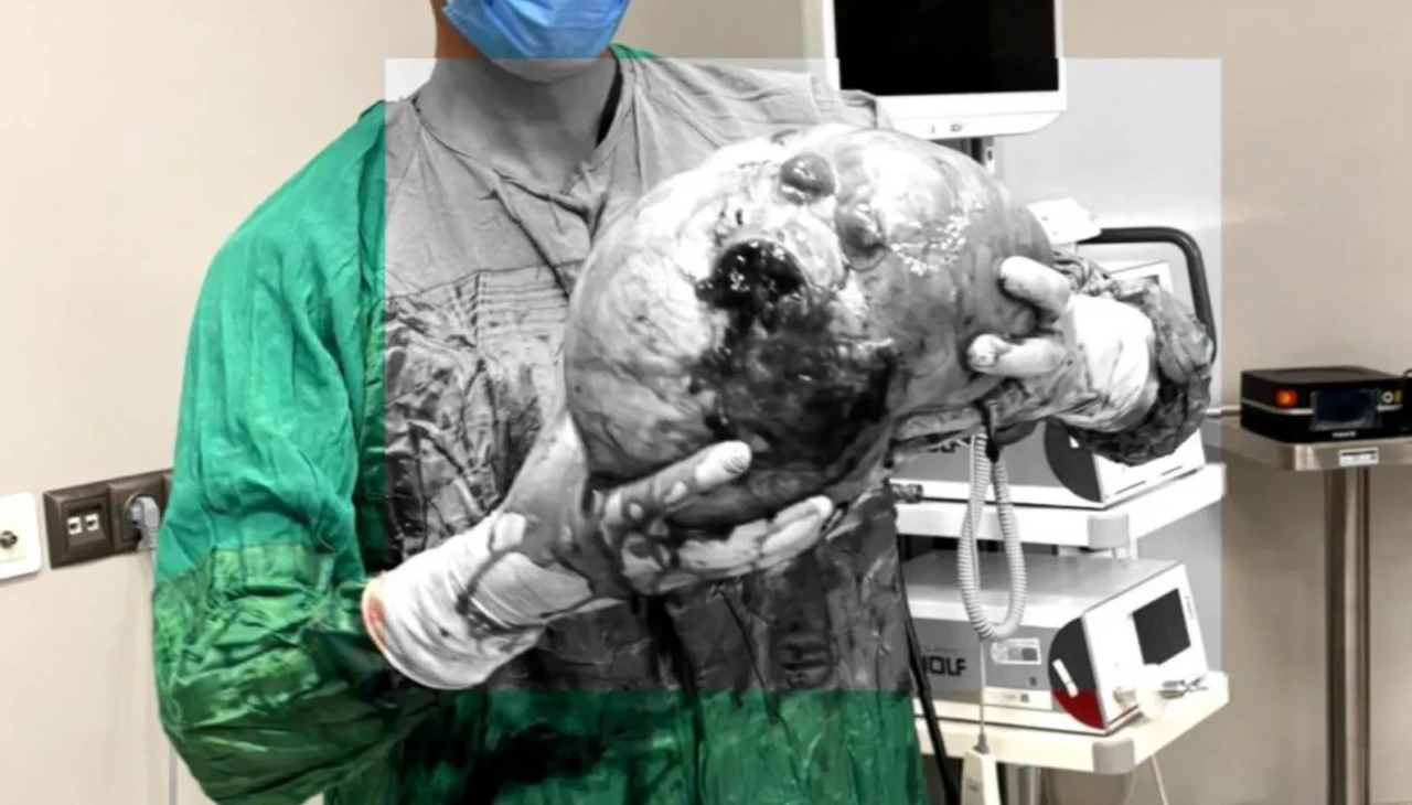 70 yaşındaki kadının yaşamını değiştiren ameliyat