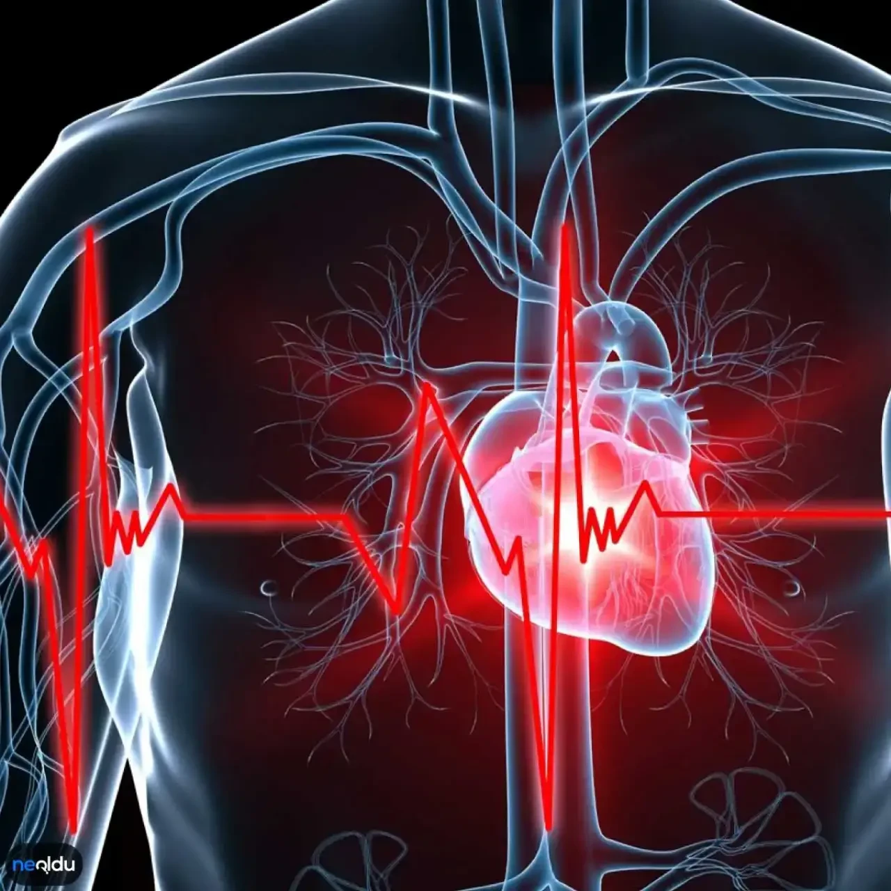 Kalbe yüksek voltajla hassas müdahale: PFA ile hızlı iyileşme mümkün