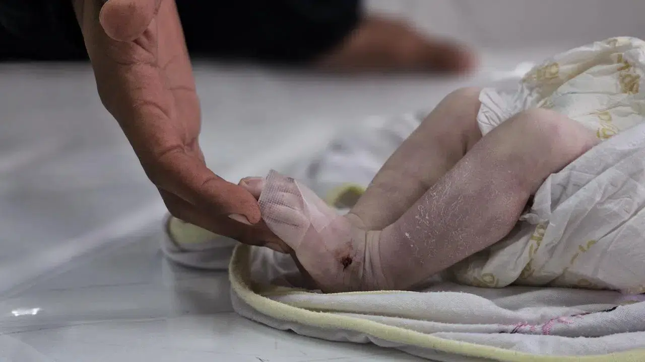 İsrail saldırıları evsiz bıraktı; 1 aylık bebek, donarak can verdi!