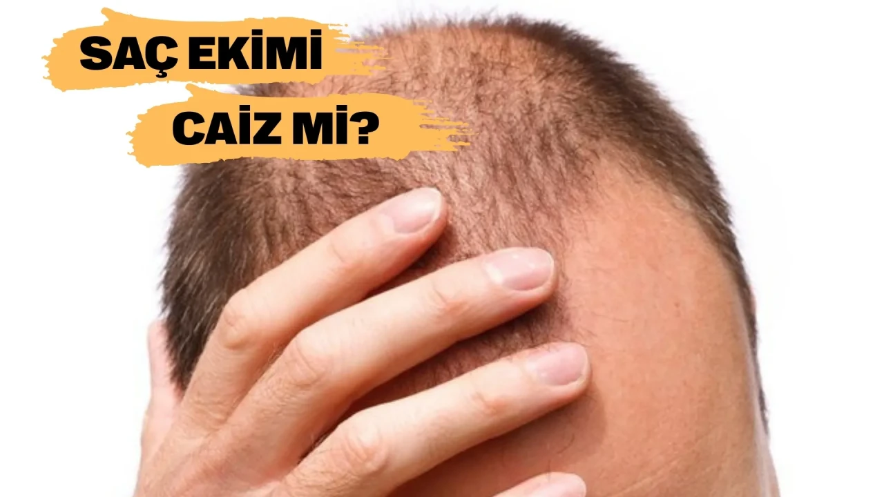 Saç ektirmek caiz mi? Diyanet’in görüşü ve İslami prensipler ışığında değerlendirme