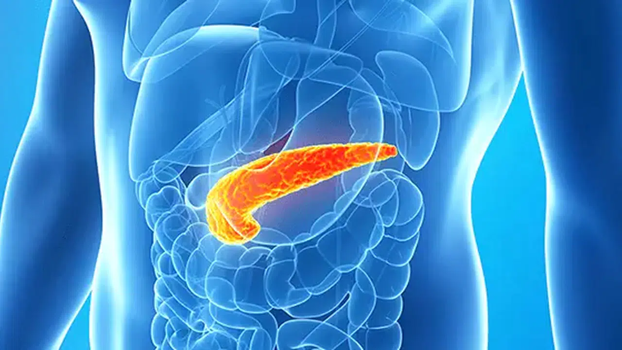 İspanya’da pankreas kanseri nasıl tedavi edildi? Pankreas tümörünü yok etti mi?