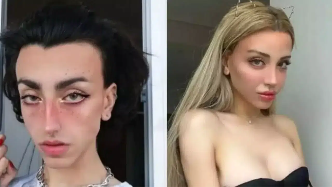 Mika Raun eski hali nasıl, erkek hali nasıldı, estetik yaptırdı mı, estetikli mi?