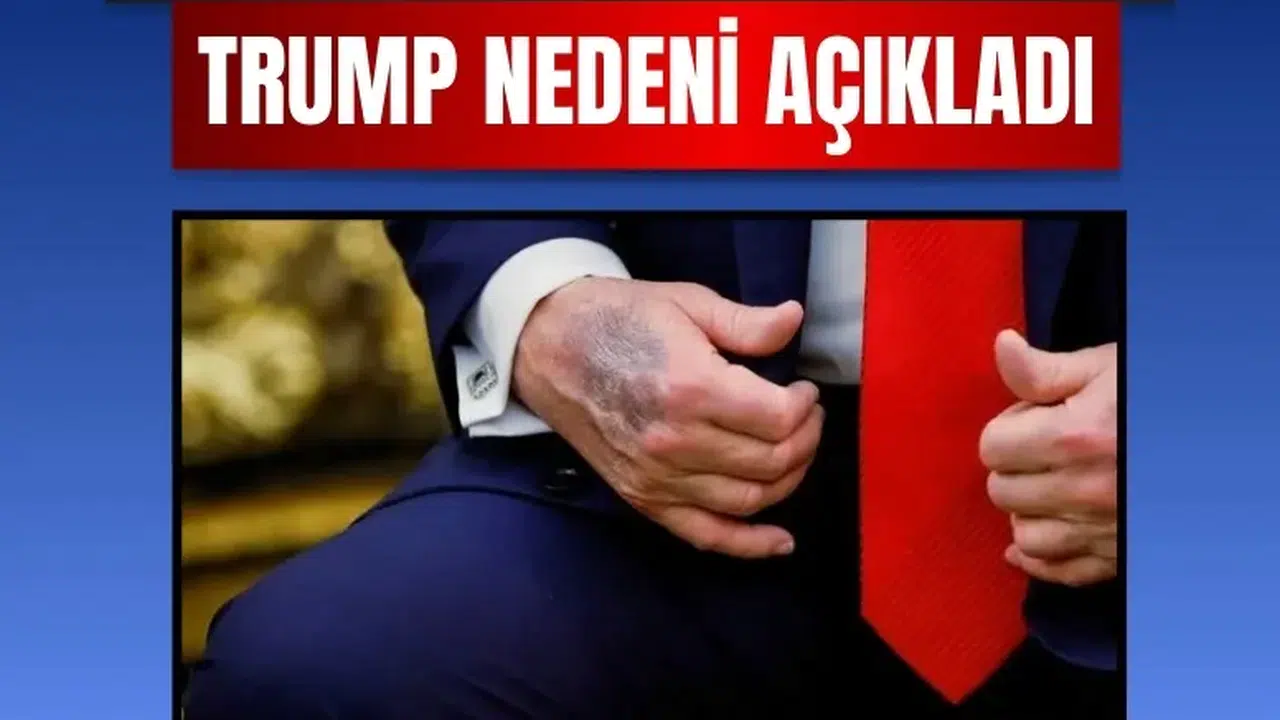 ABD Başkanı Trump elindeki morluklarla ilgili söylentilere noktayı koydu