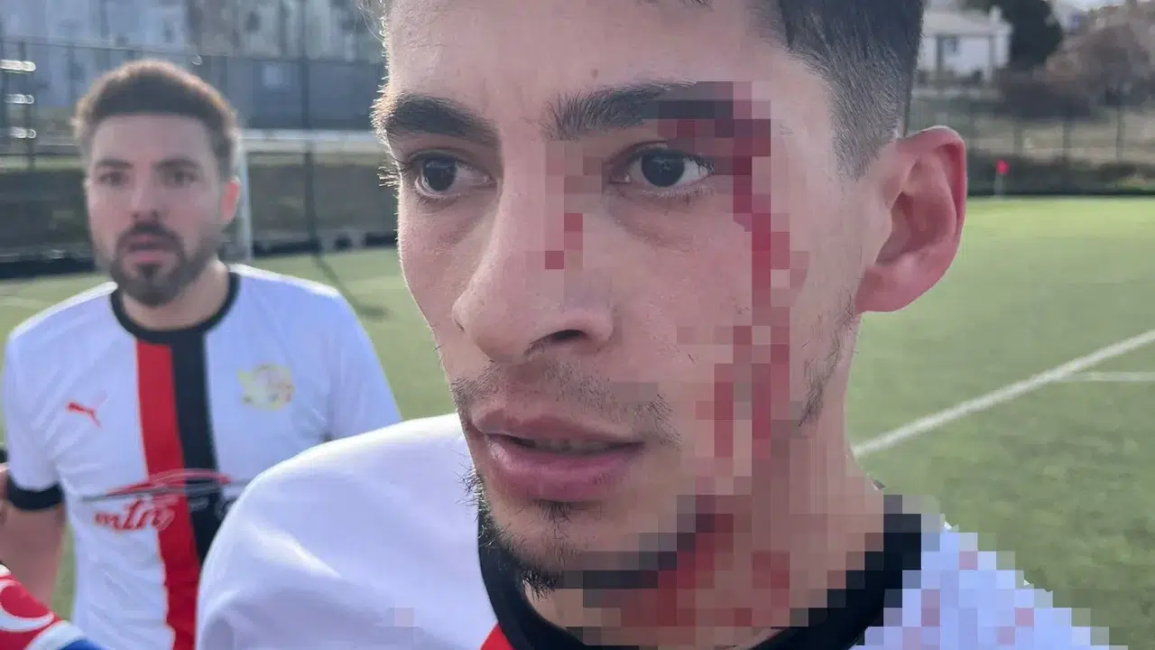 Maç bitti, saha karıştı! Gülümbespor futbolcuları hastanelik oldu