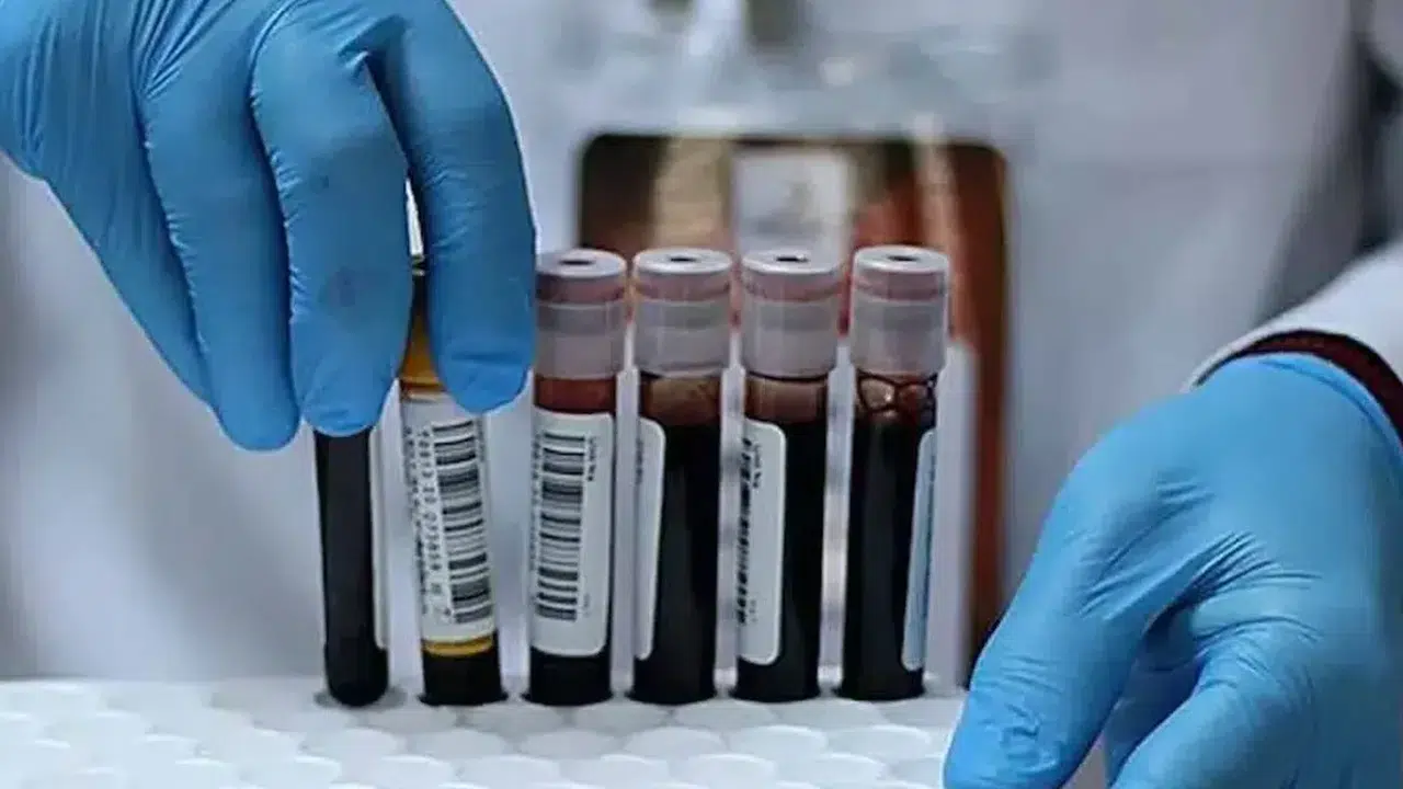 A, B ve AB kan gruplarında kanser ve erken ölüm riski yüksek mi, kan grubu sağlığı etkiliyor mu?