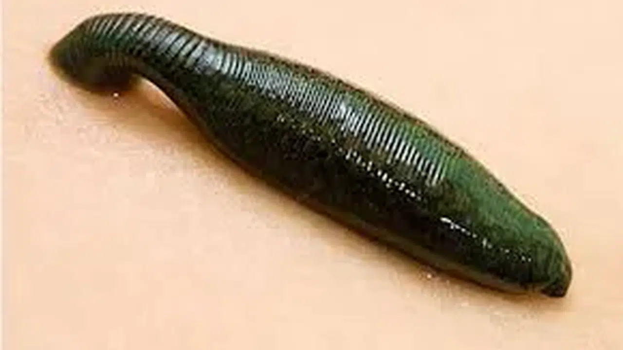 Sülük Ne İşe Yarar,  Faydaları Nelerdir, Hangi Hastalıklara İyi Gelir?