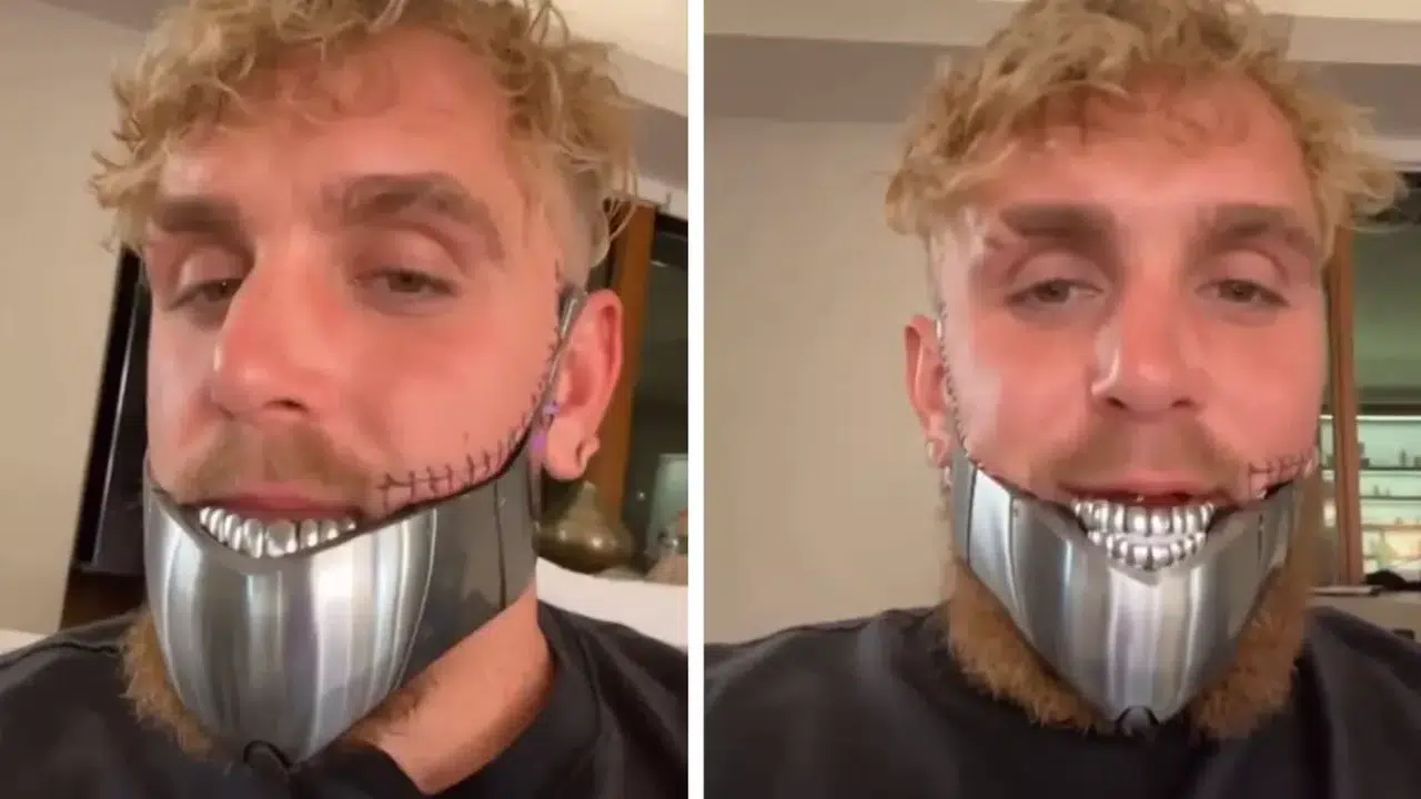 Joshua Maçı Sonrası Kabus Bitmiyor: Jake Paul Yeniden Ameliyat Oldu