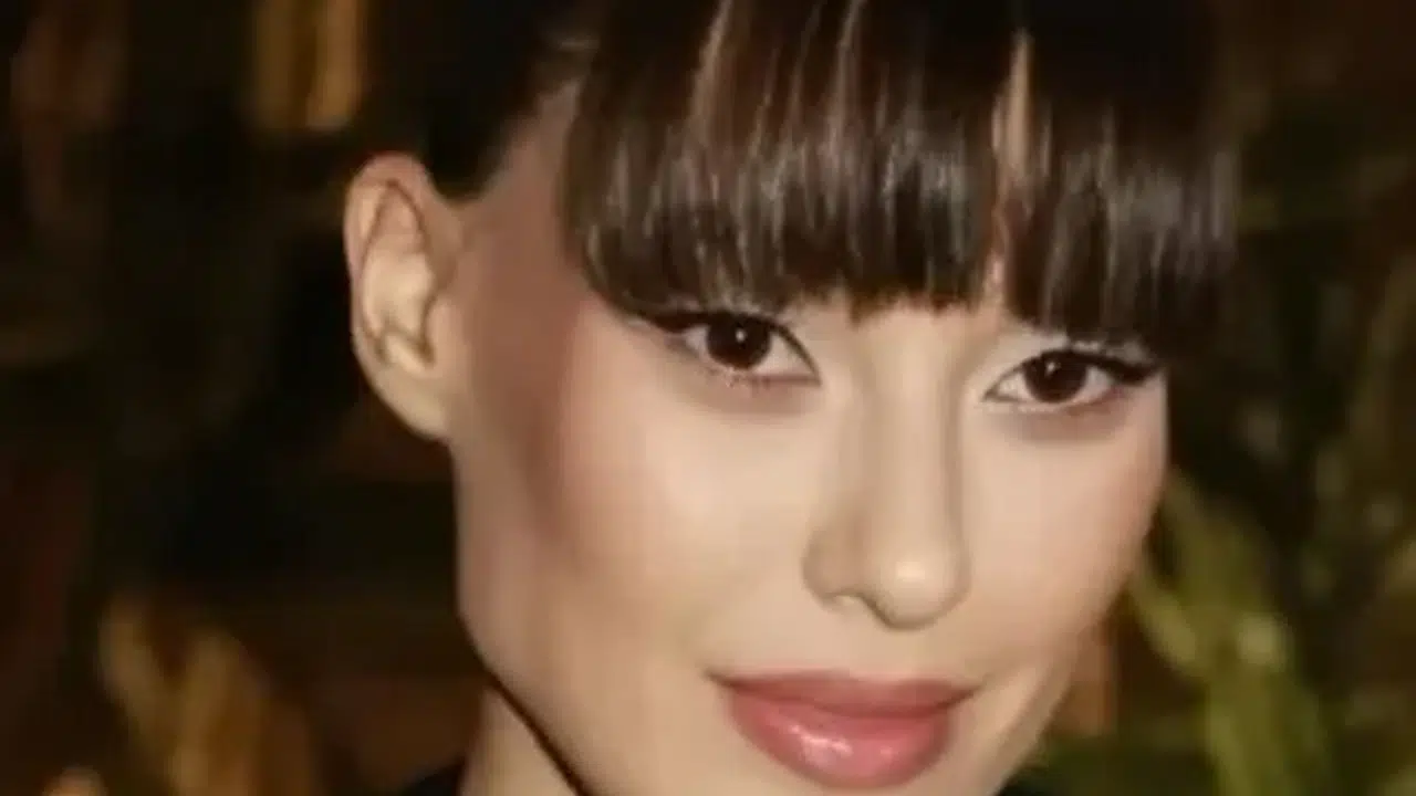 Dilan Çiçek Deniz ne oldu, estetik mi oldu, badem göz, çene dolgusu, Fransız askısı iddiaları doğru mu?