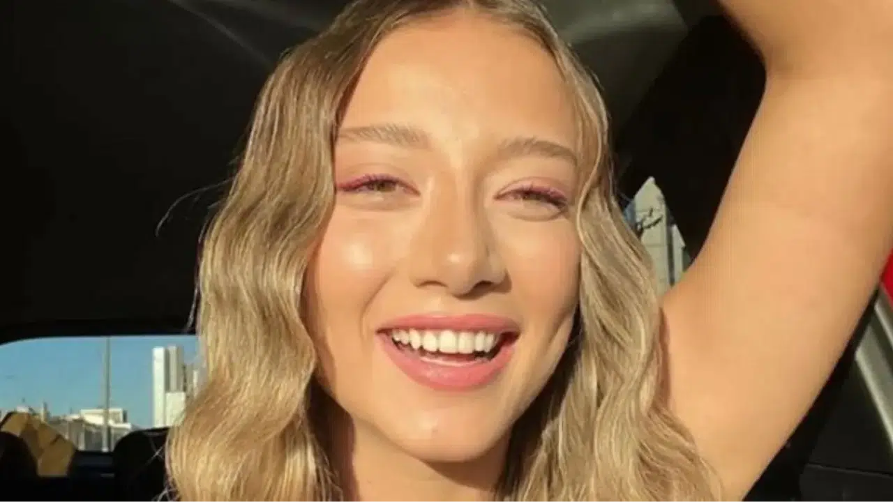 Survivor Aleyna Kalaycıoğlu estetik mi yaptırdı, yüz hatları değişti mi? Burun estetiği sonrası son hali nasıl?