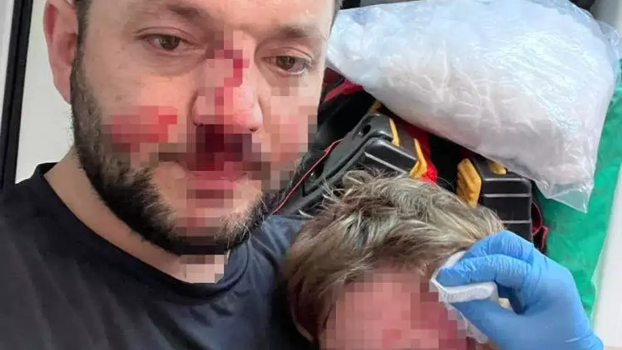 Komşu kavgası kanlı bitti, 14 aylık bebek hastanelik oldu