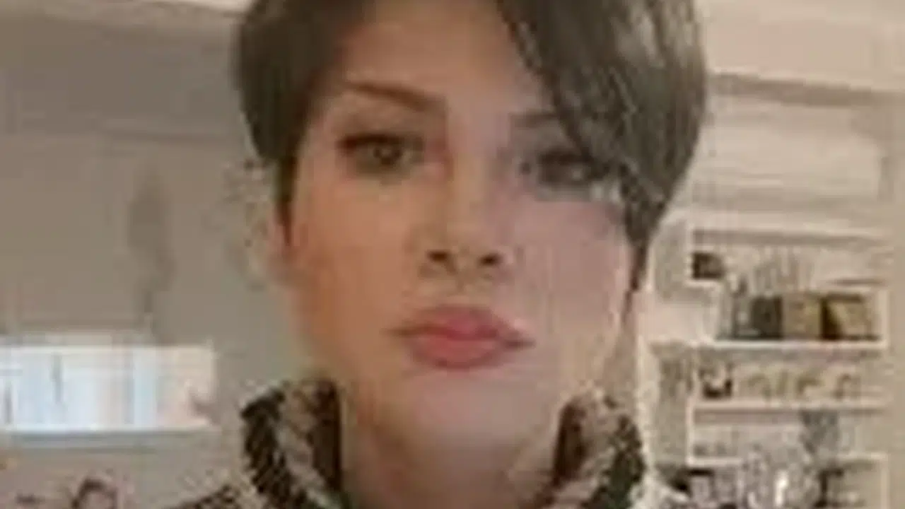 Aydilge'nin hasta mı, hastalığı nedir?