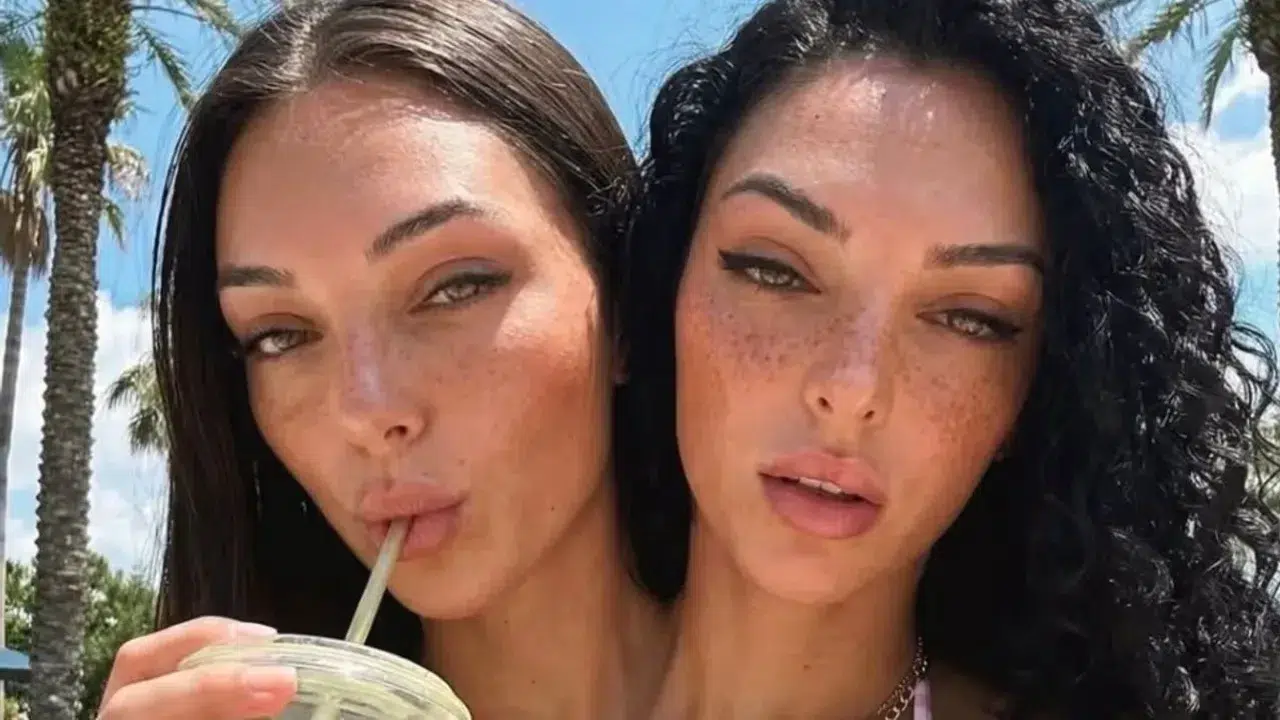 288 Bin Takipçi, Büyük Şüphe! Yapışık İkizler Tartışması Alevlendi