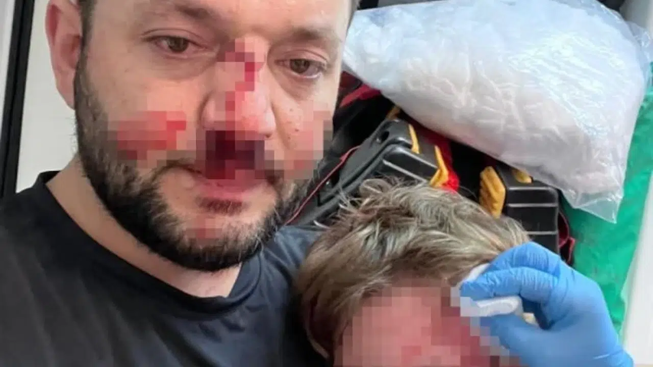 Yalova’da Ne Oldu, 14 Aylık Bebeğin Kafatasını Kim Çatlattı?