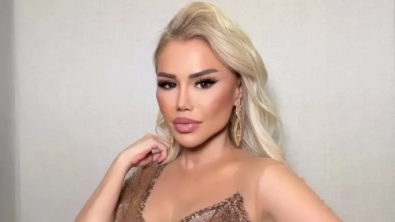 Ceylan estetiğe veda etti! Yüzü artık estetiği kabul etmiyor