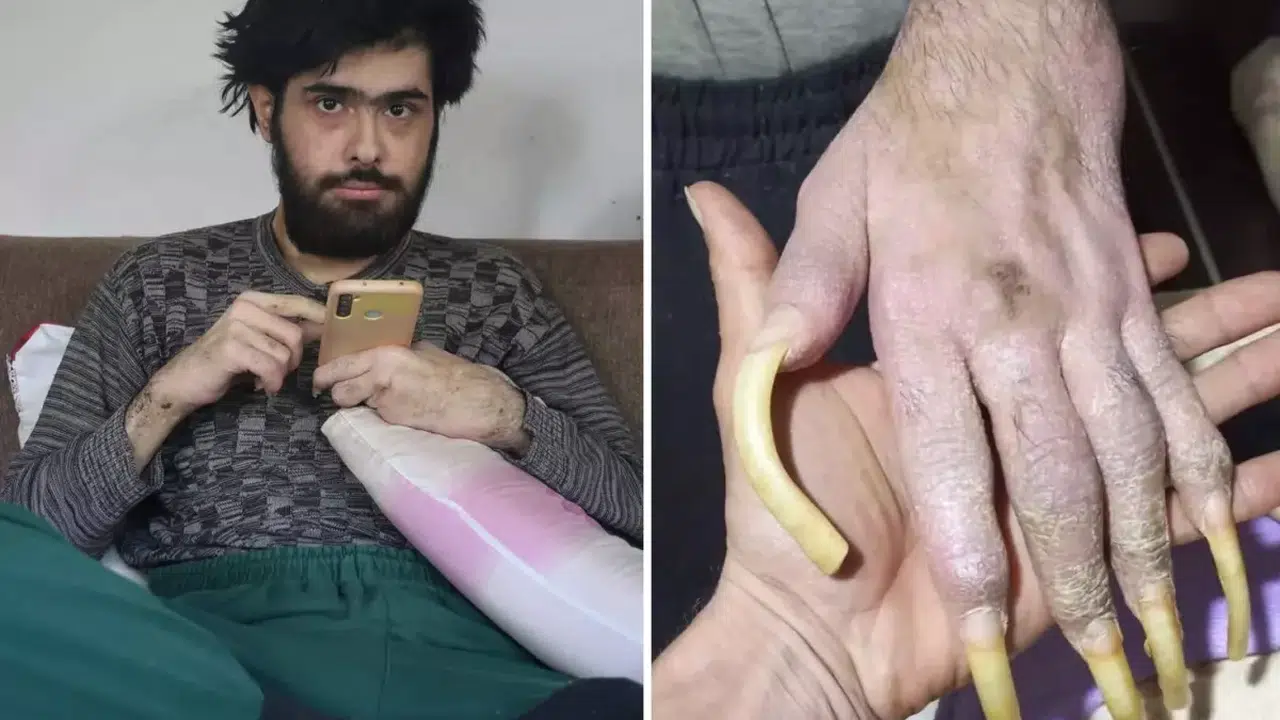 Barış Özbay’ın son hali ve yeni mesleği gündemde!